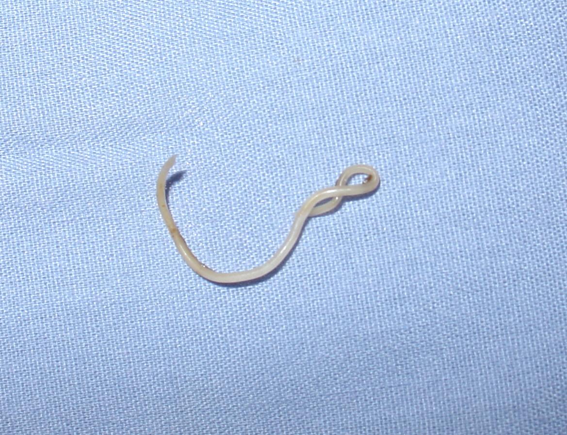 Toxocara canis roundworm