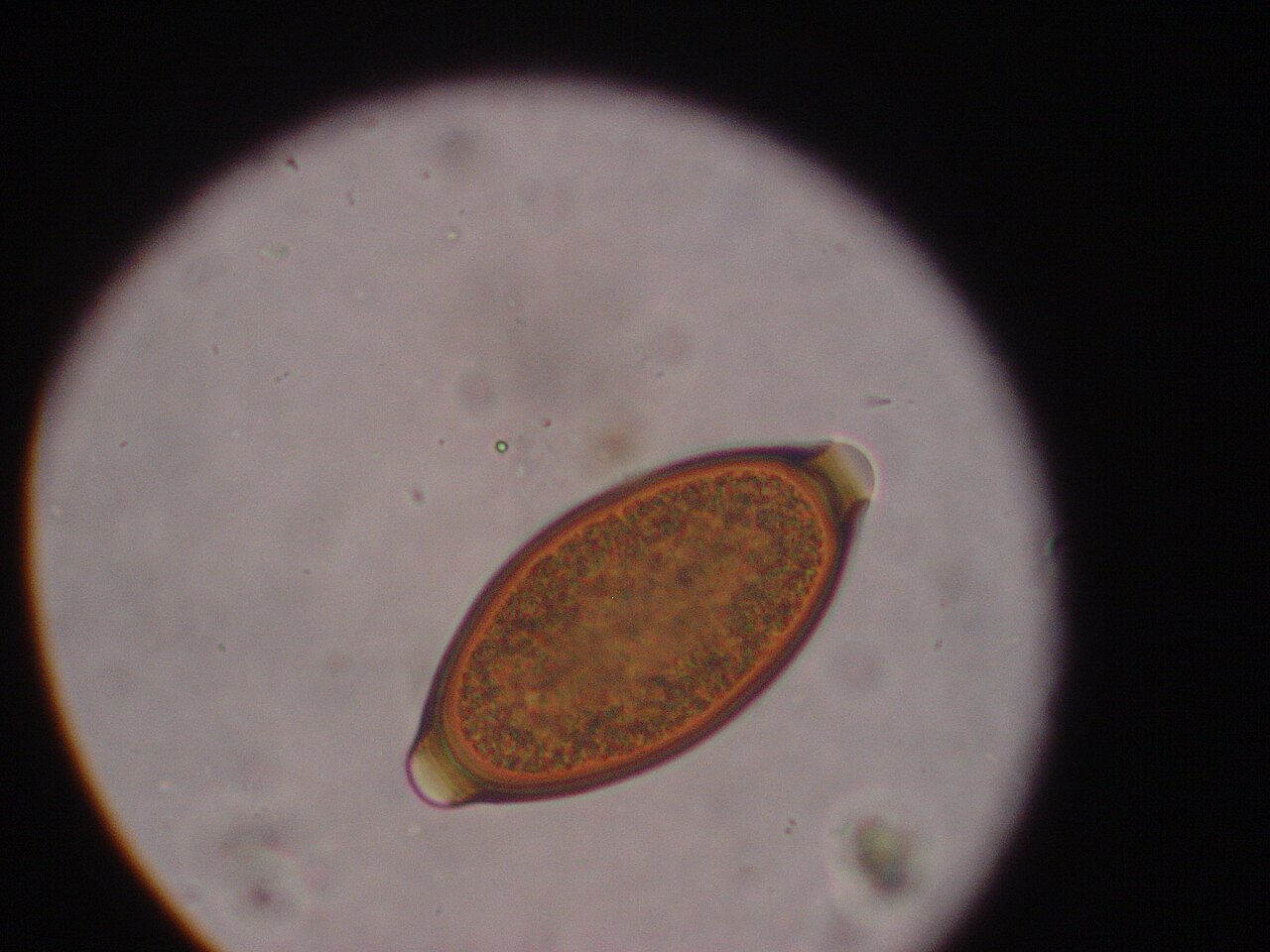 Whipworm egg